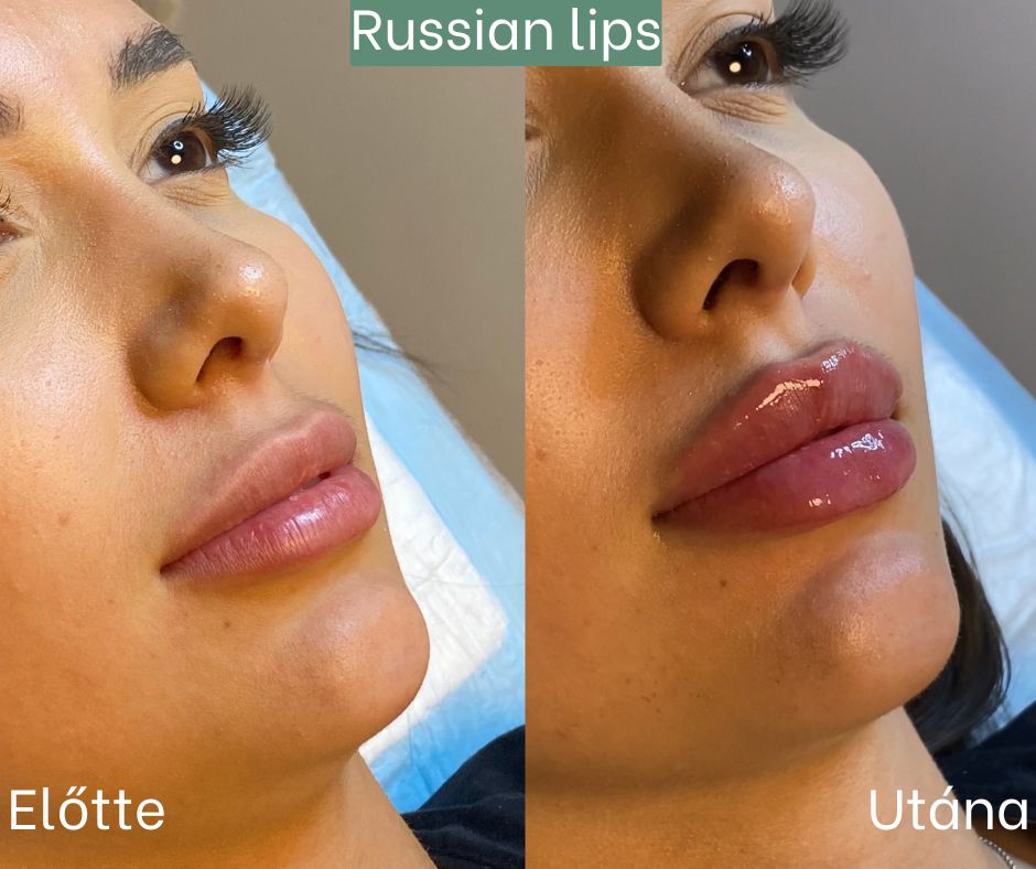 russian lips