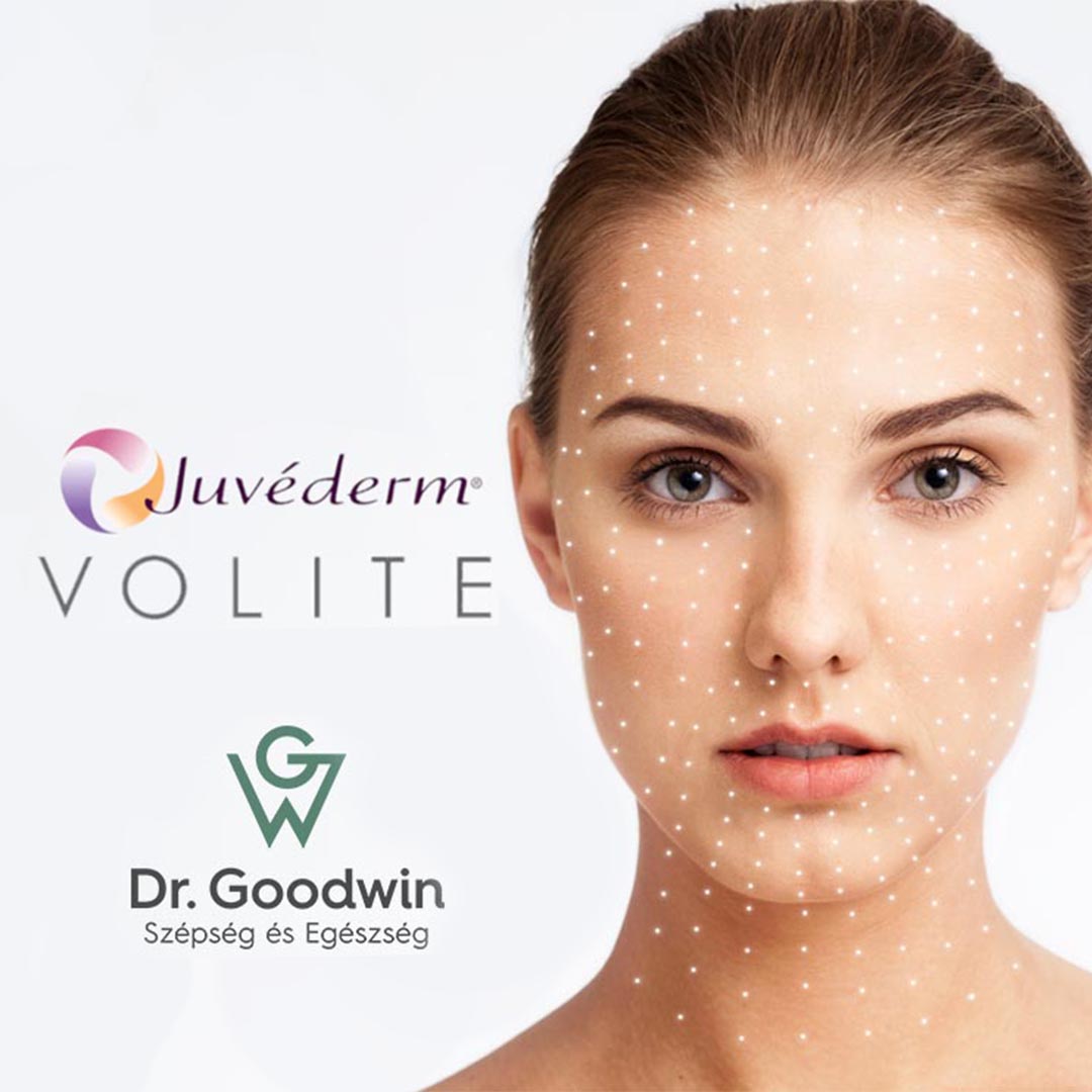Juvederm Volite - The Magical Renewal of Skin!
