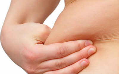 Abdominoplasty: More Than Just External Transformation