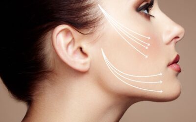 Thread Lifting: Natural Facial Rejuvenation Without Surgery, With Lasting Results