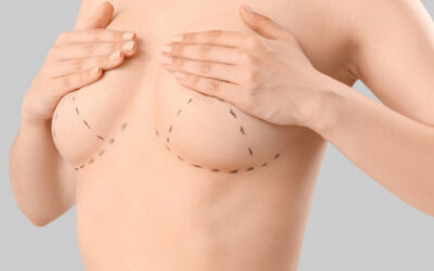 Breast Surgery: A Comprehensive Guide to Breast Shaping – Options, Benefits, Processes