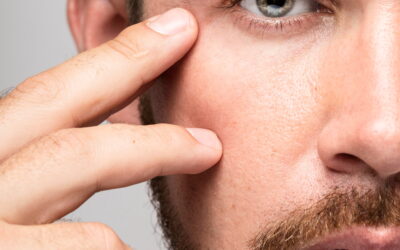 Botox for Men: When Is It Recommended, What Is It Good For, and How Natural Is the Result?