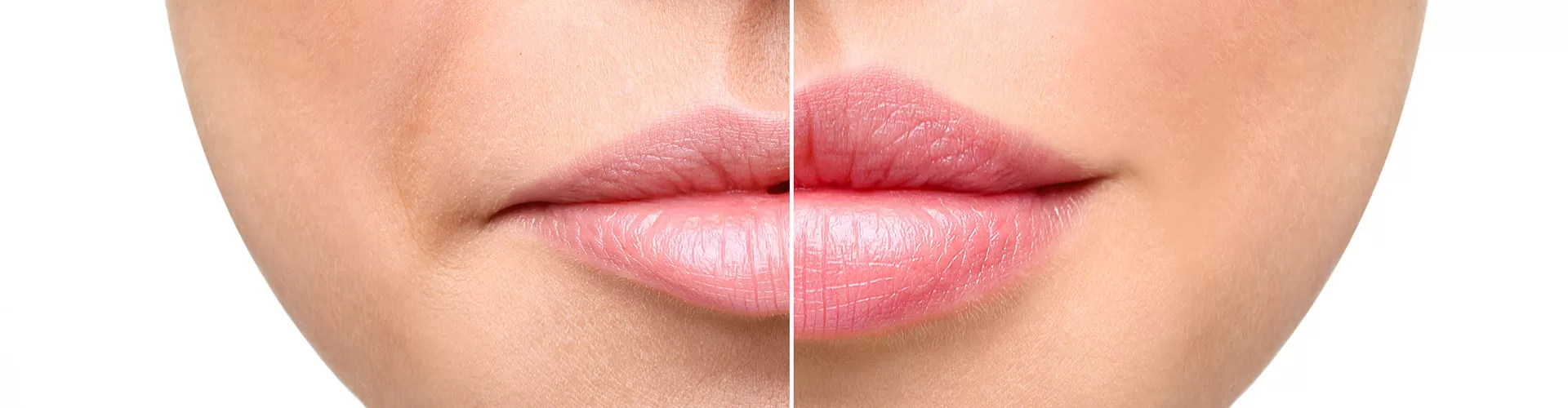 Russian lips