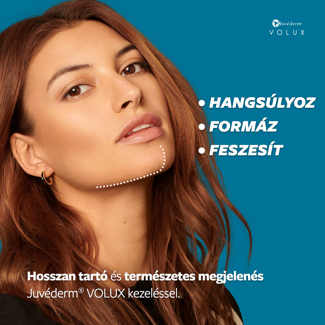 Juvéderm VOLUX ®Állvonal kontúrozás Juvéderm VOLUX ®Állvonal kontúrozás