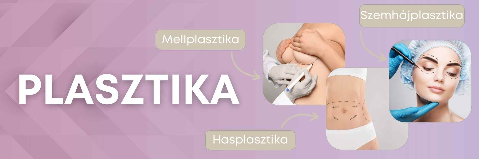 plasztikai beavatkozások plasztikai beavatkozások
