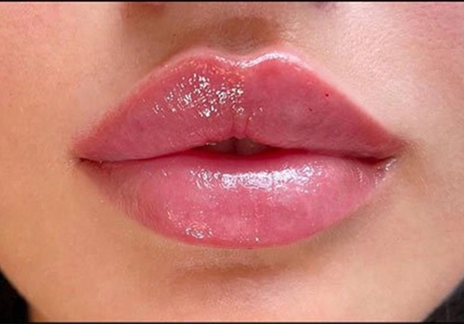 Russian lips